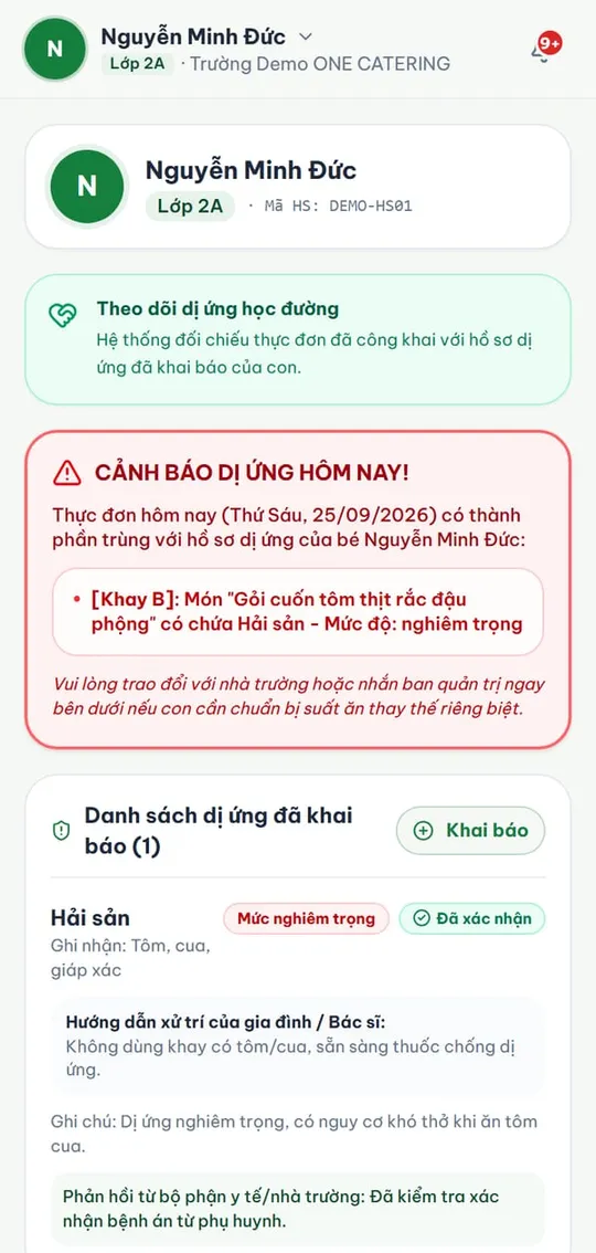 Dị ứng của con